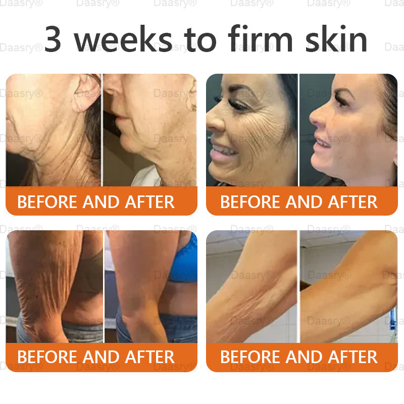 Mayo & Cleveland Clinic Store: Made and Shipped from USA - Natravor™"Dermal Gold" Botox Bee Venom Skin Restoration Cream - LAST DAY 80% OFF