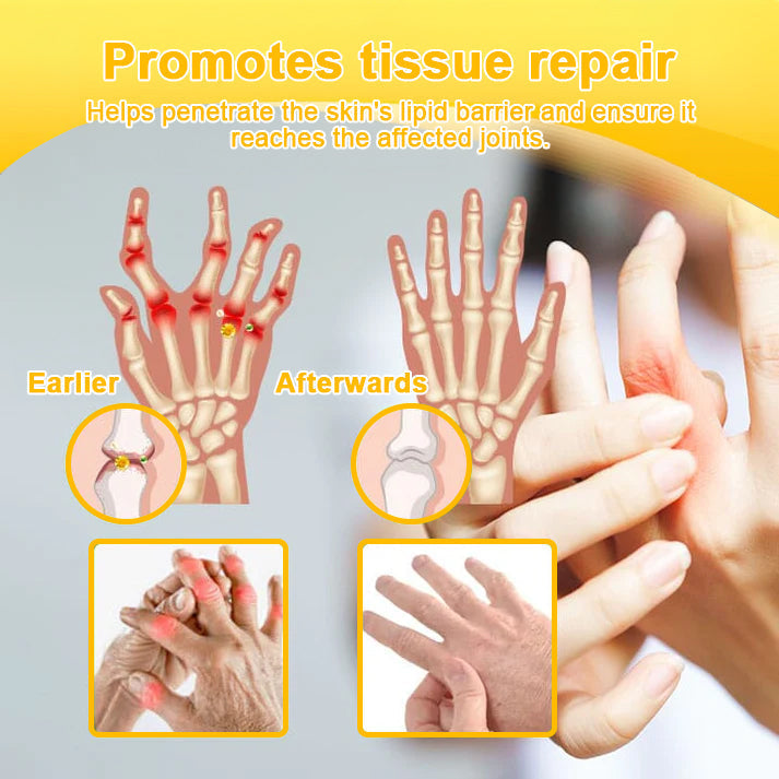 Natravor™ Botulinum Toxin & Bee Venom Pain-Relief Bone Healing Cream