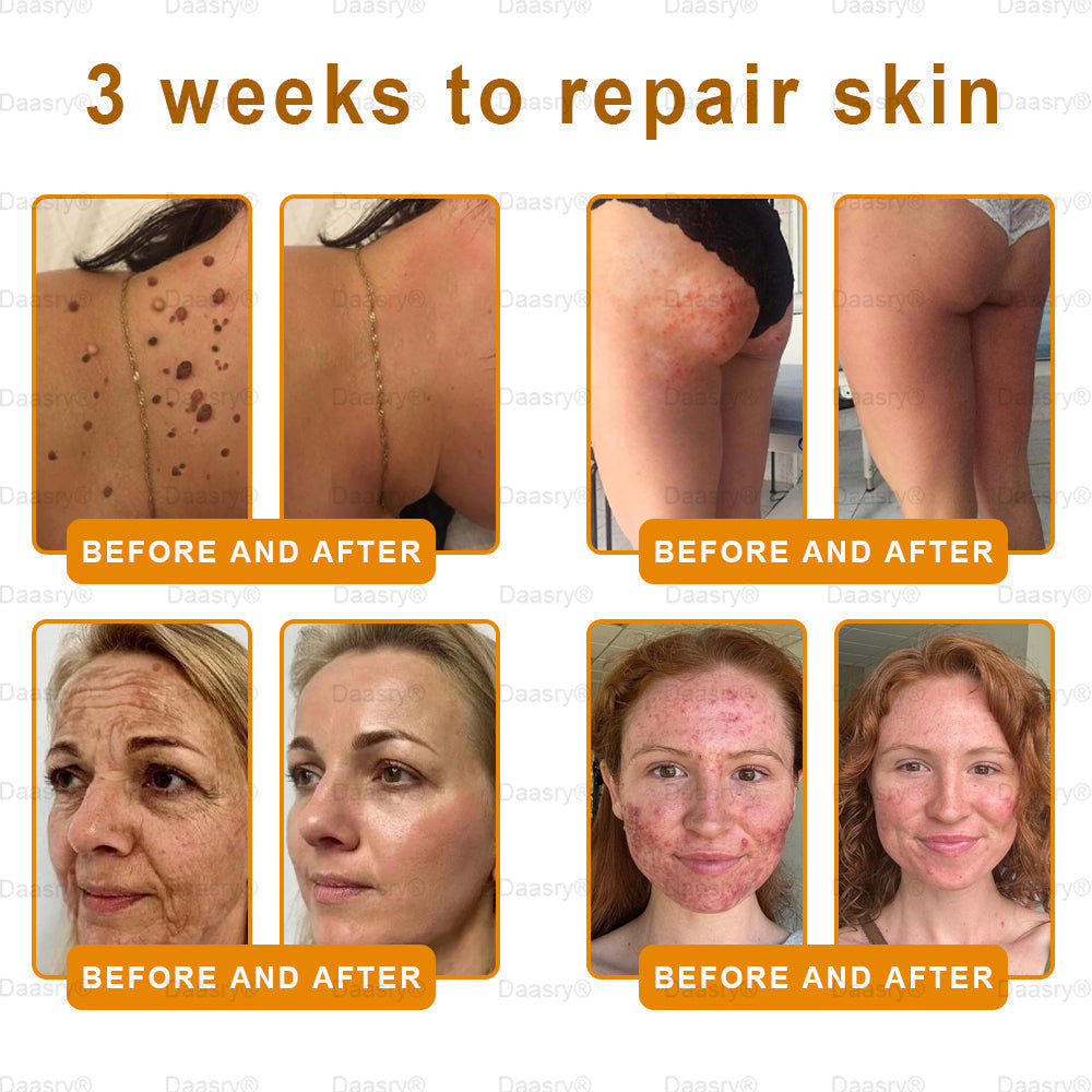 Mayo & Cleveland Clinic Store: Made and Shipped from USA - Natravor™"Dermal Gold" Botox Bee Venom Skin Restoration Cream - LAST DAY 80% OFF