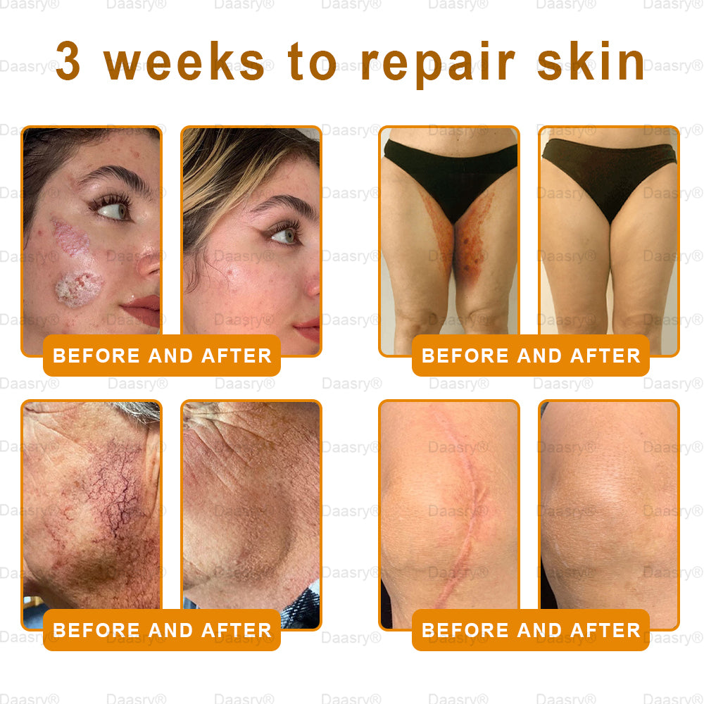 Mayo & Cleveland Clinic Store: Made and Shipped from USA - Natravor™"Dermal Gold" Botox Bee Venom Skin Restoration Cream - LAST DAY 80% OFF