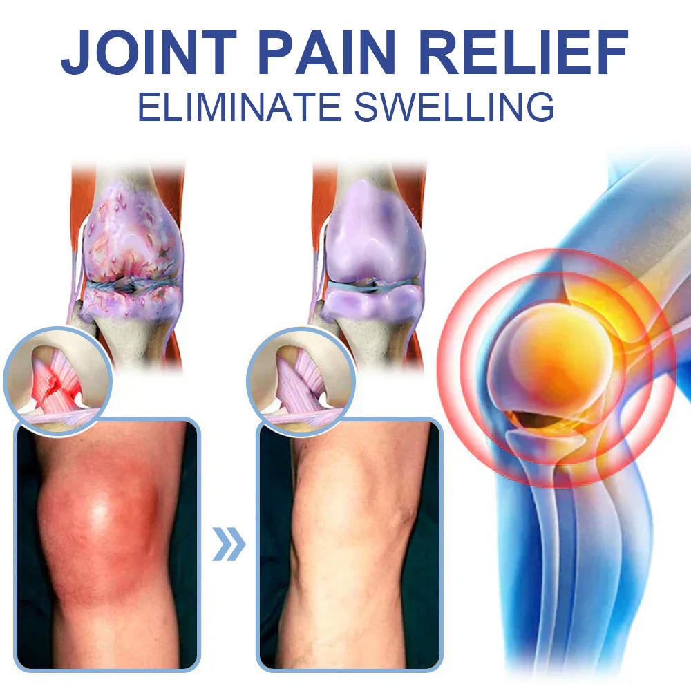 ✅NHS Approved: Natravor™ Magnesium Pain Healing Bone Cream (Relief of neuropathy, muscle spasms, twitches or cramps, poor bone health and other arthritis)