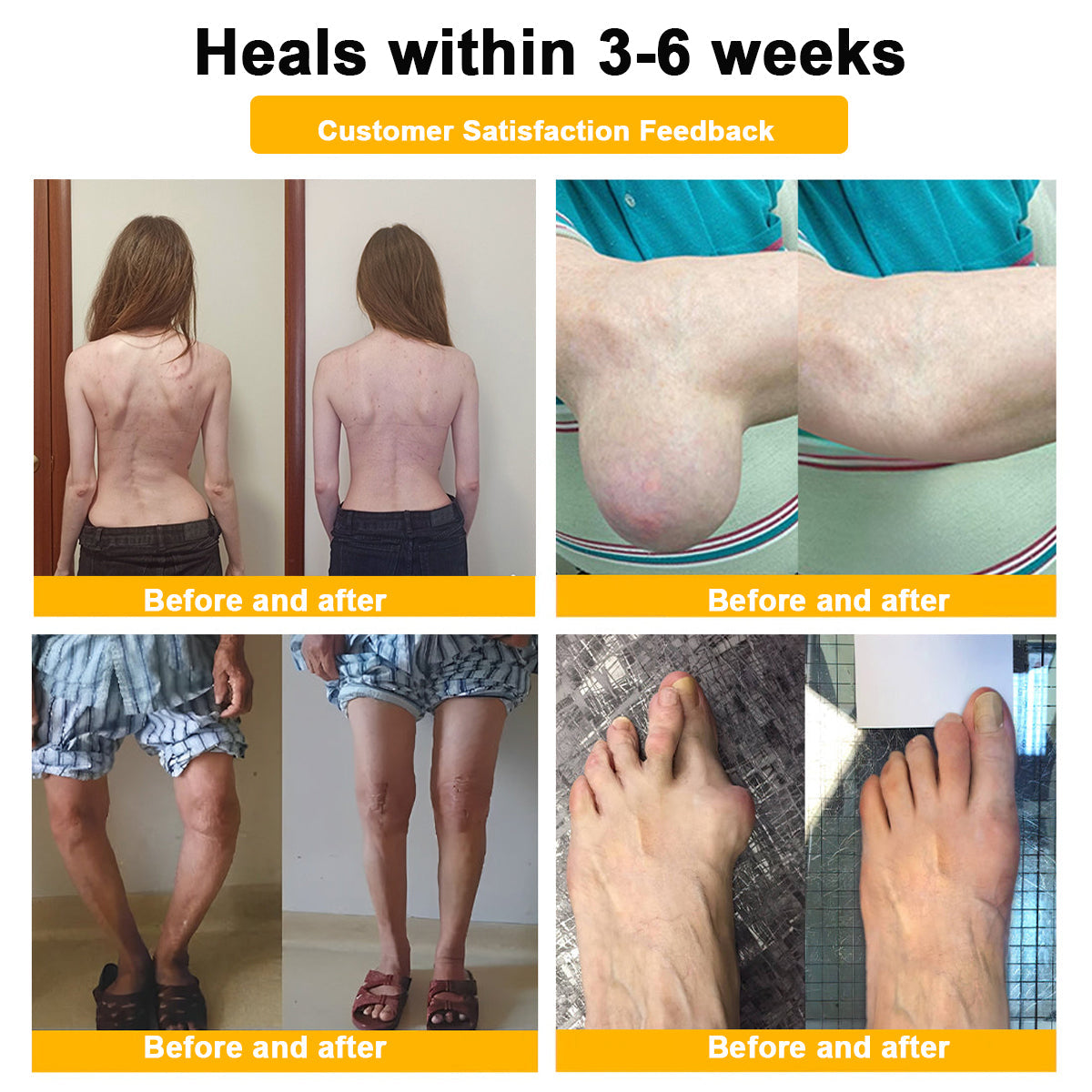 Natravor™ Botulinum Toxin & Bee Venom Pain-Relief Bone Healing Cream
