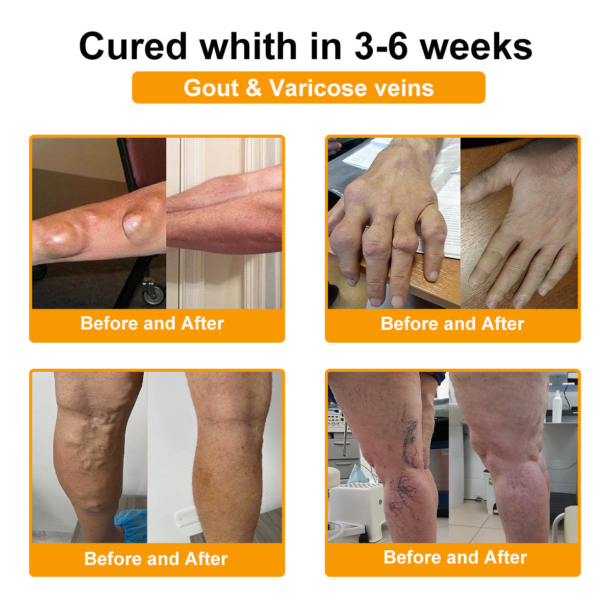 Natravor™ Botulinum Toxin & Bee Venom Pain-Relief Bone Healing Cream