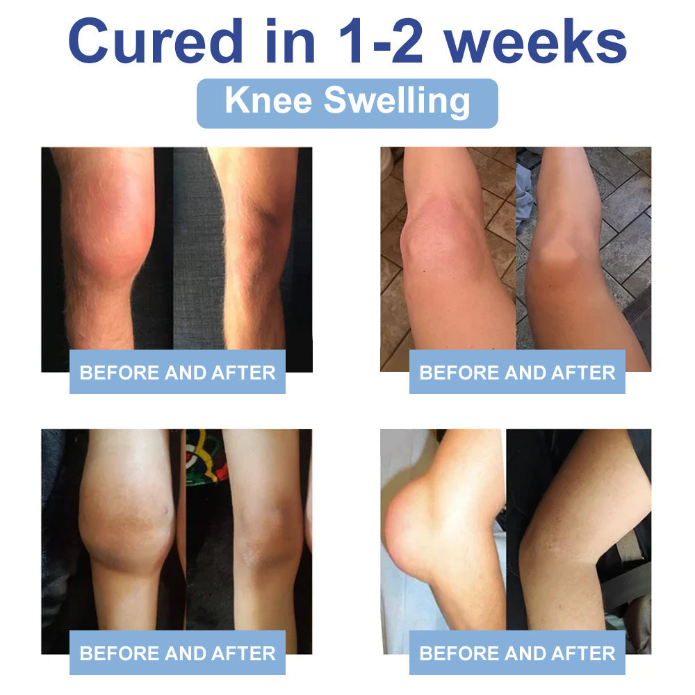 ✅NHS Approved: Natravor™ Magnesium Pain Healing Bone Cream (Relief of neuropathy, muscle spasms, twitches or cramps, poor bone health and other arthritis)