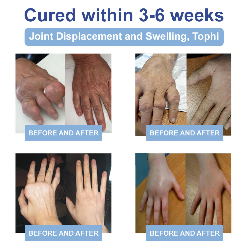 ✅NHS Approved: Natravor™ Magnesium Pain Healing Bone Cream (Relief of neuropathy, muscle spasms, twitches or cramps, poor bone health and other arthritis)