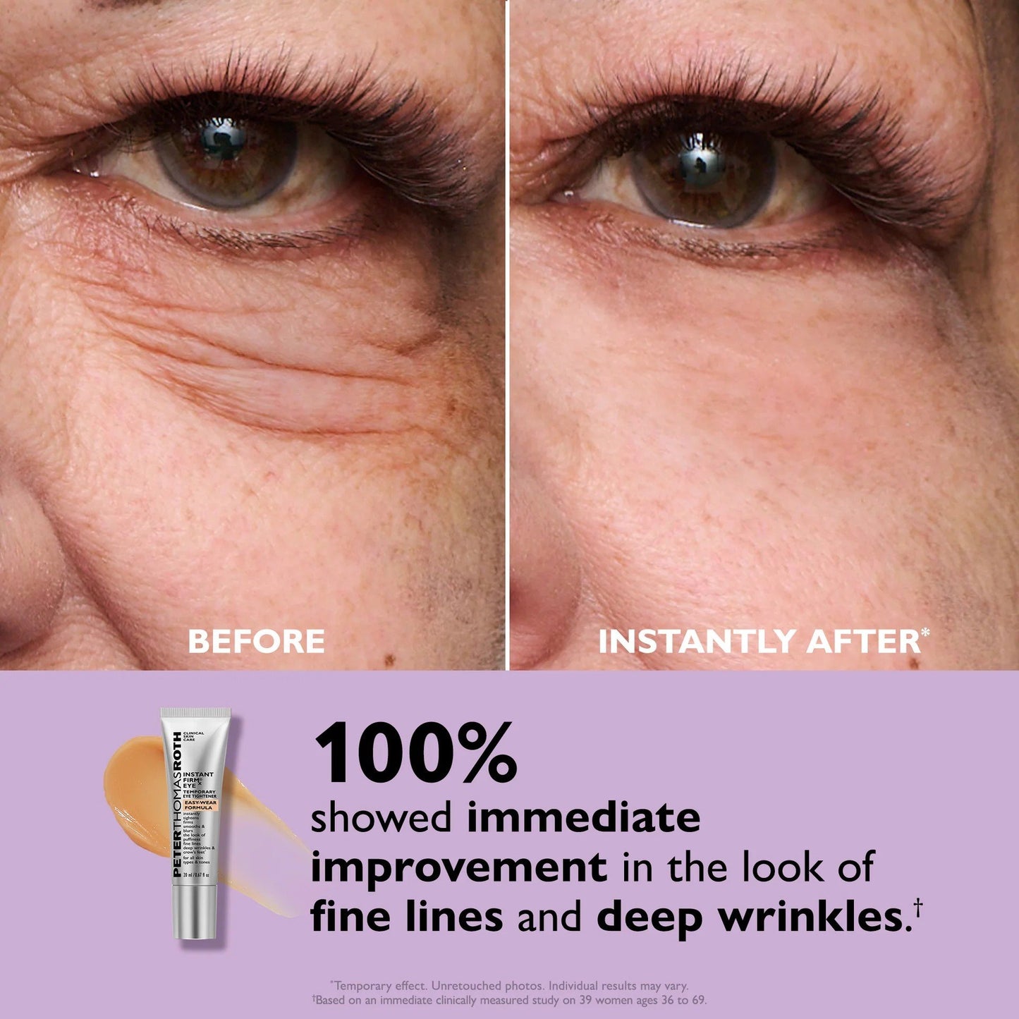 ⏳ LAST CHANCE: 70% OFF Instant Eye Tightener!