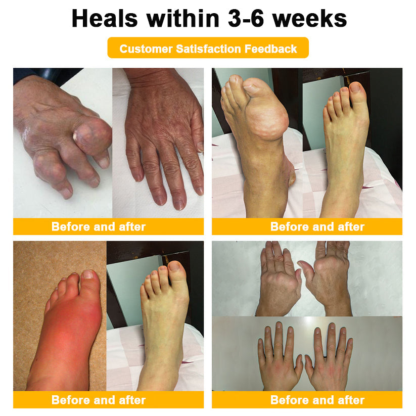 Natravor™ Botulinum Toxin & Bee Venom Pain-Relief Bone Healing Cream