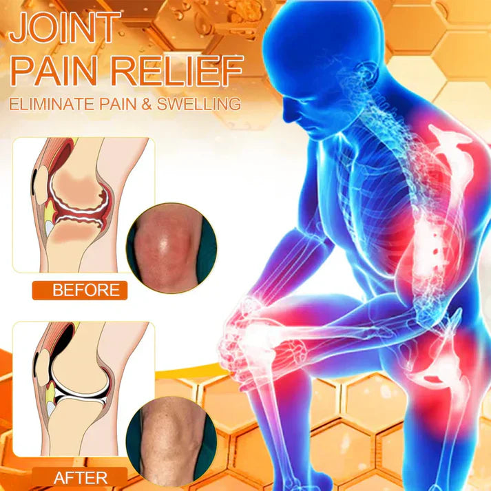 💧🐝Natravor™ Magnesium Oil & Bee Venom Joint Healing Spray👨⚕️Approved by the British Orthopaedic Association (BOA)