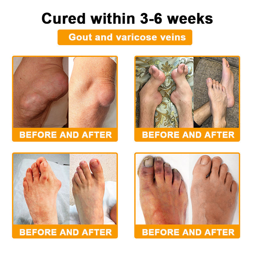 Natravor™ Botulinum Toxin & Bee Venom Pain-Relief Bone Healing Cream