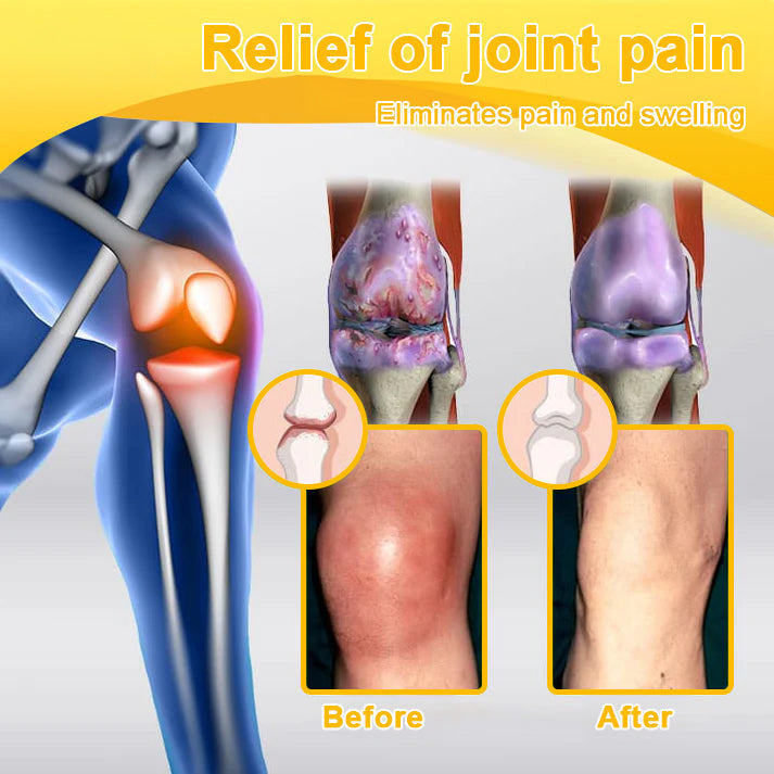 Natravor™ Botulinum Toxin & Bee Venom Pain-Relief Bone Healing Cream
