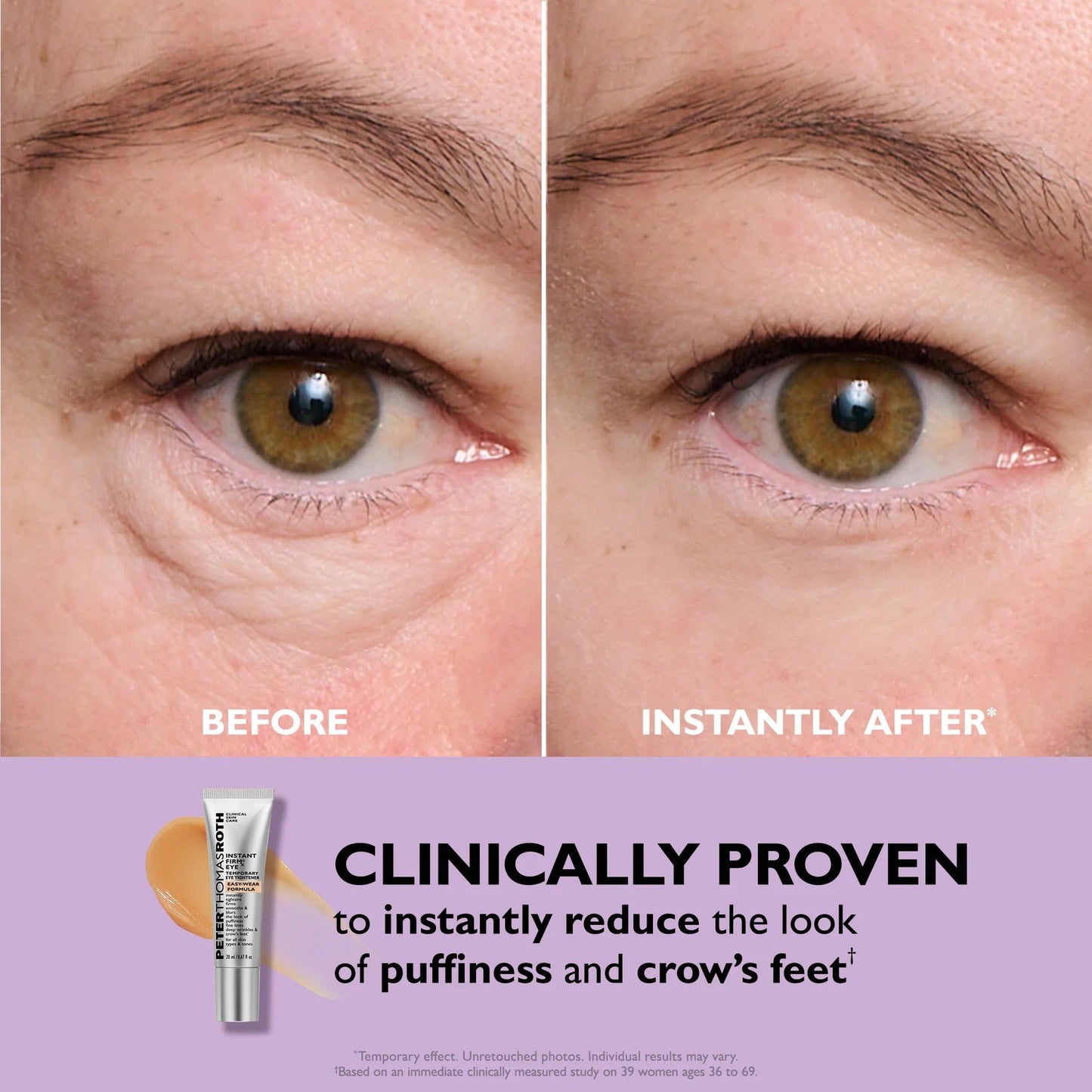 ⏳ LAST CHANCE: 70% OFF Instant Eye Tightener!