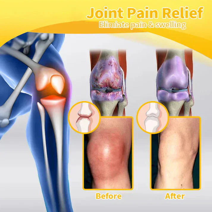 💧🐝Natravor™ Magnesium Oil & Bee Venom Joint Healing Spray👨⚕️Approved by the British Orthopaedic Association (BOA)
