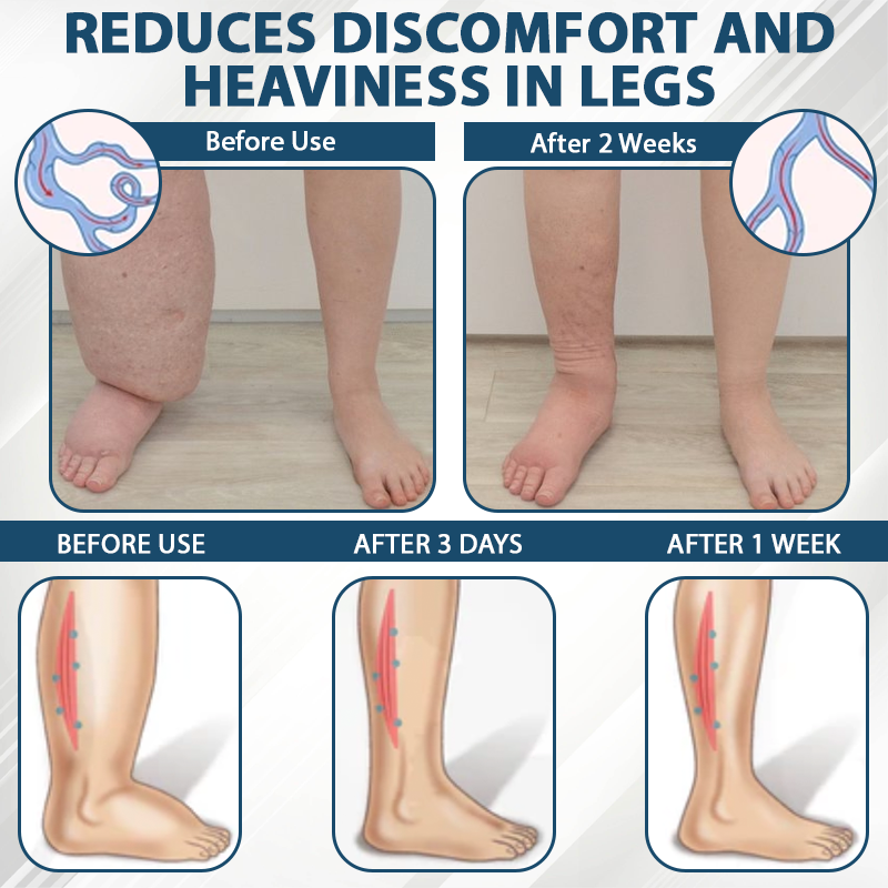 Natravor™ VenoHerb Black Cumin Edema Relief Balm