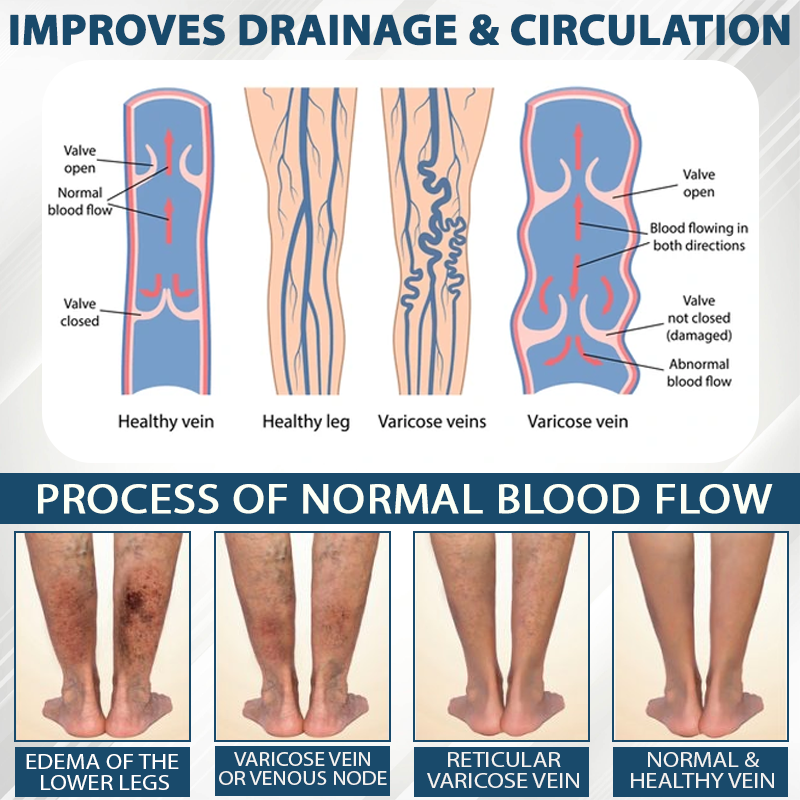 Natravor™ VenoHerb Black Cumin Edema Relief Balm