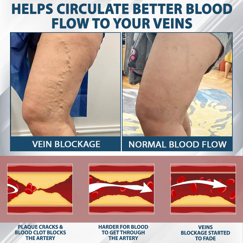 Natravor™ VenoHerb Black Cumin Edema Relief Balm