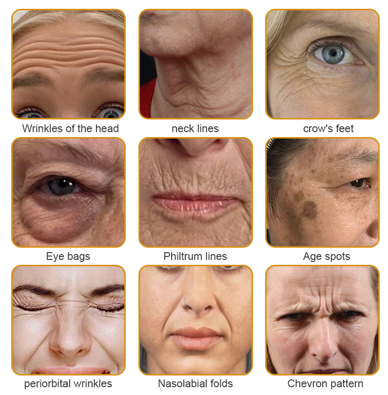 💎👨⚕️Made and shipped from the UK✨Natravor™ Botox Bee Venom Wrinkle Removal Cream-Last Day Promotion 70% OFF