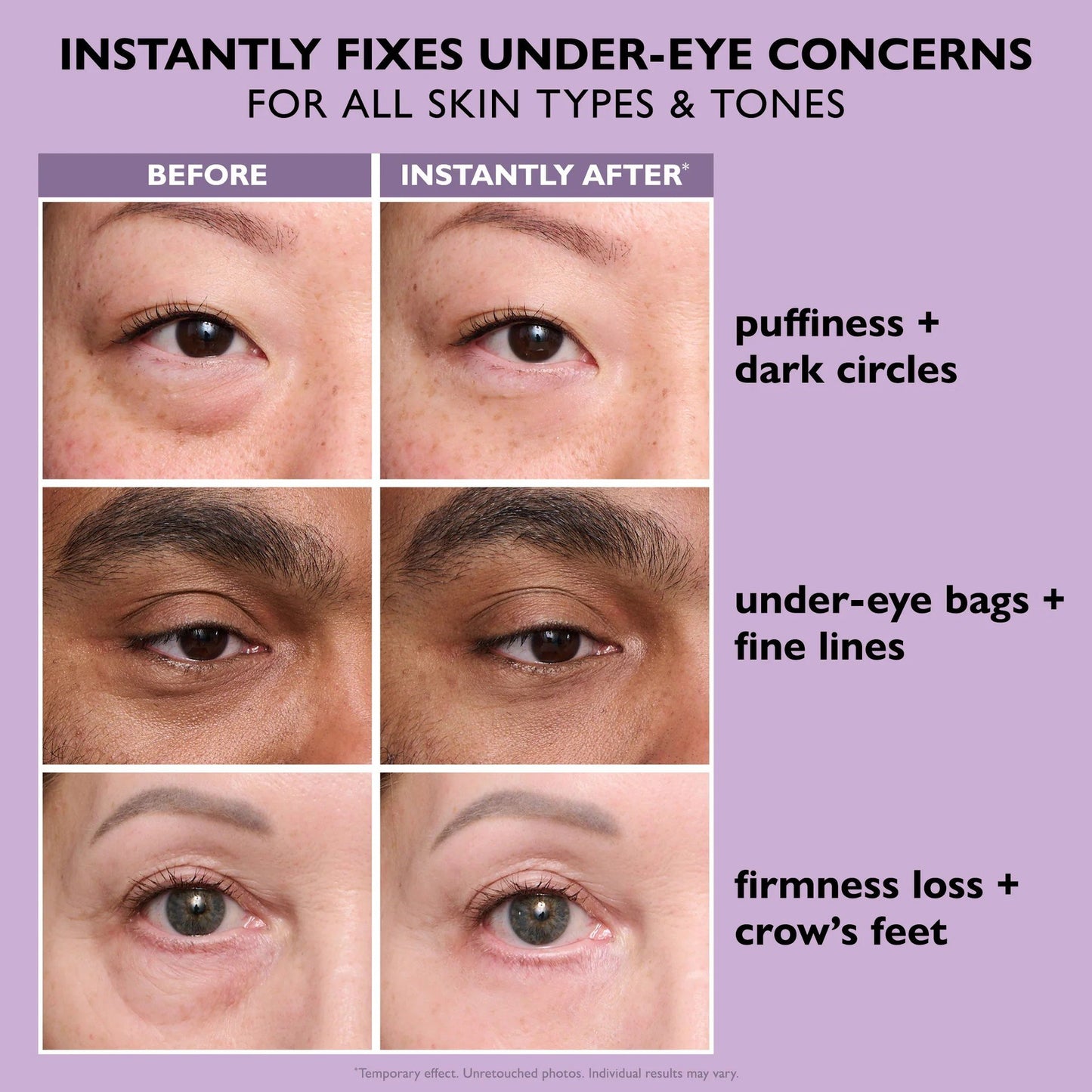 ⏳ LAST CHANCE: 70% OFF Instant Eye Tightener!