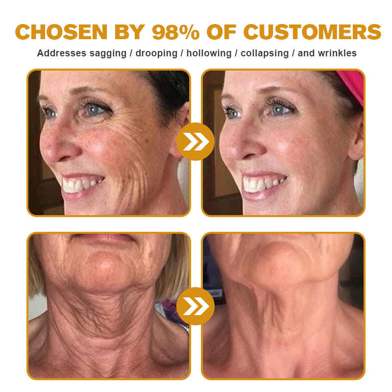 💎👨⚕️Made and shipped from the UK✨Natravor™ Botox Bee Venom Wrinkle Removal Cream-Last Day Promotion 70% OFF