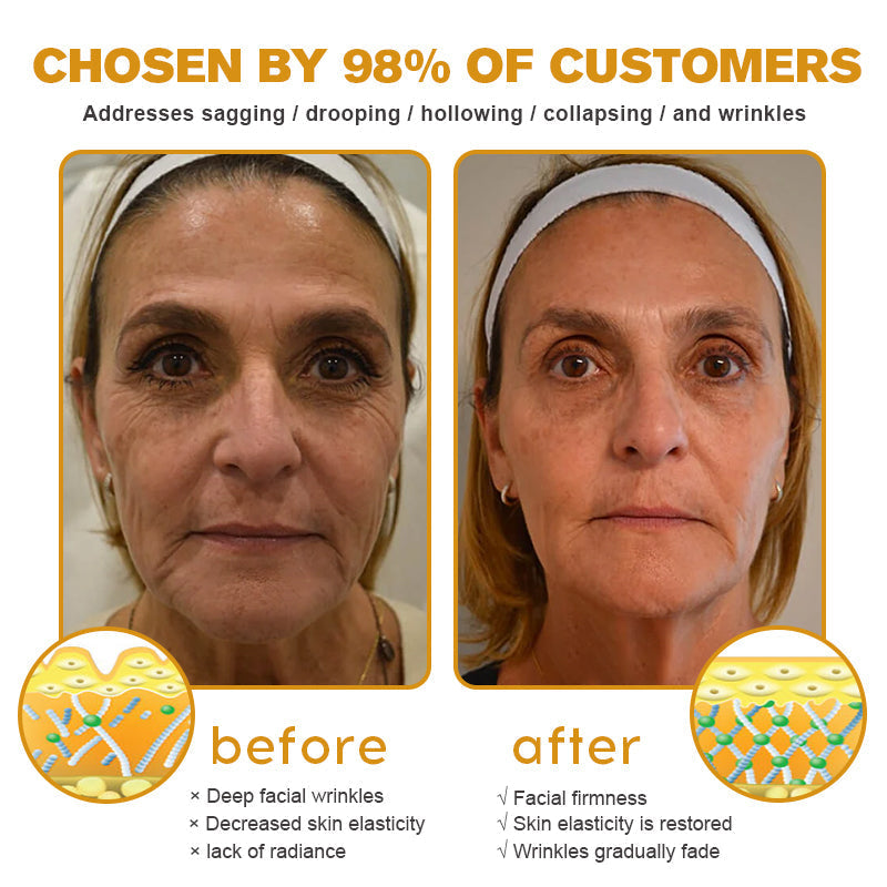 💎👨⚕️Made and shipped from the UK✨Natravor™ Botox Bee Venom Wrinkle Removal Cream-Last Day Promotion 70% OFF