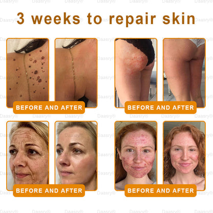 Mayo & Cleveland Clinic Store: Made and Shipped from USA - Natravor™"Dermal Gold" Botox Bee Venom Skin Restoration Cream - LAST DAY 80% OFF