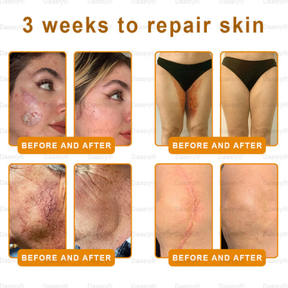 Mayo & Cleveland Clinic Store: Made and Shipped from USA - Natravor™"Dermal Gold" Botox Bee Venom Skin Restoration Cream - LAST DAY 80% OFF