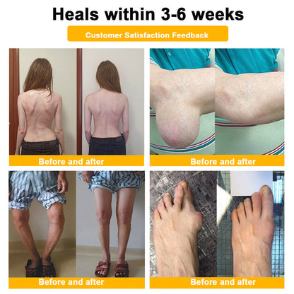 Ｎatravor™ Botulinum Toxin & Bee Venom Pain-Relief Bone Healing Cream