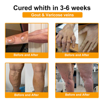 Ｎatravor™ Botulinum Toxin & Bee Venom Pain-Relief Bone Healing Cream