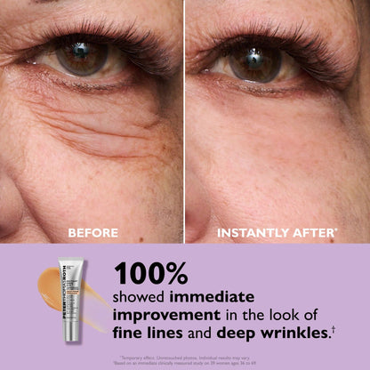 ⏳ LAST CHANCE: 70% OFF Instant Eye Tightener!