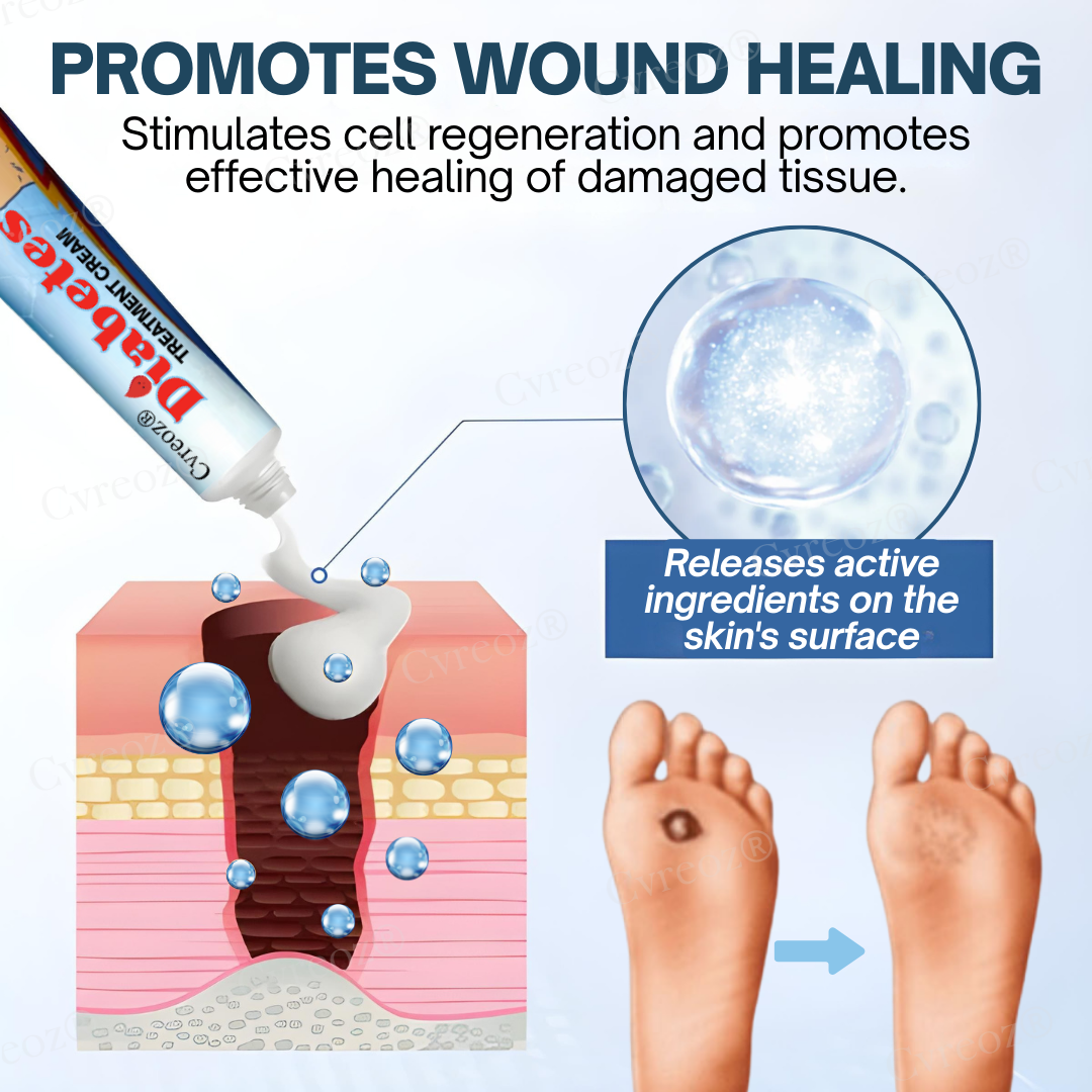 ⏰ Limited Time 50% Off! Natravor™ Diabetes Treatment Cream