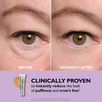 ⏳ LAST CHANCE: 70% OFF Instant Eye Tightener!