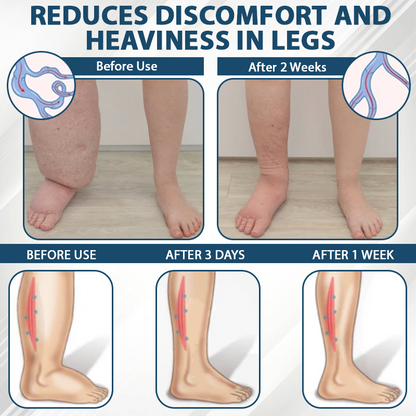 Natravor™ VenoHerb Black Cumin Edema Relief Balm