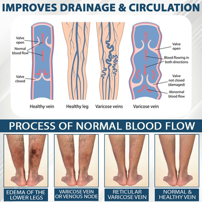 Natravor™ VenoHerb Black Cumin Edema Relief Balm