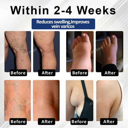 Natravor™ VenoHerb Black Cumin Edema Relief Balm