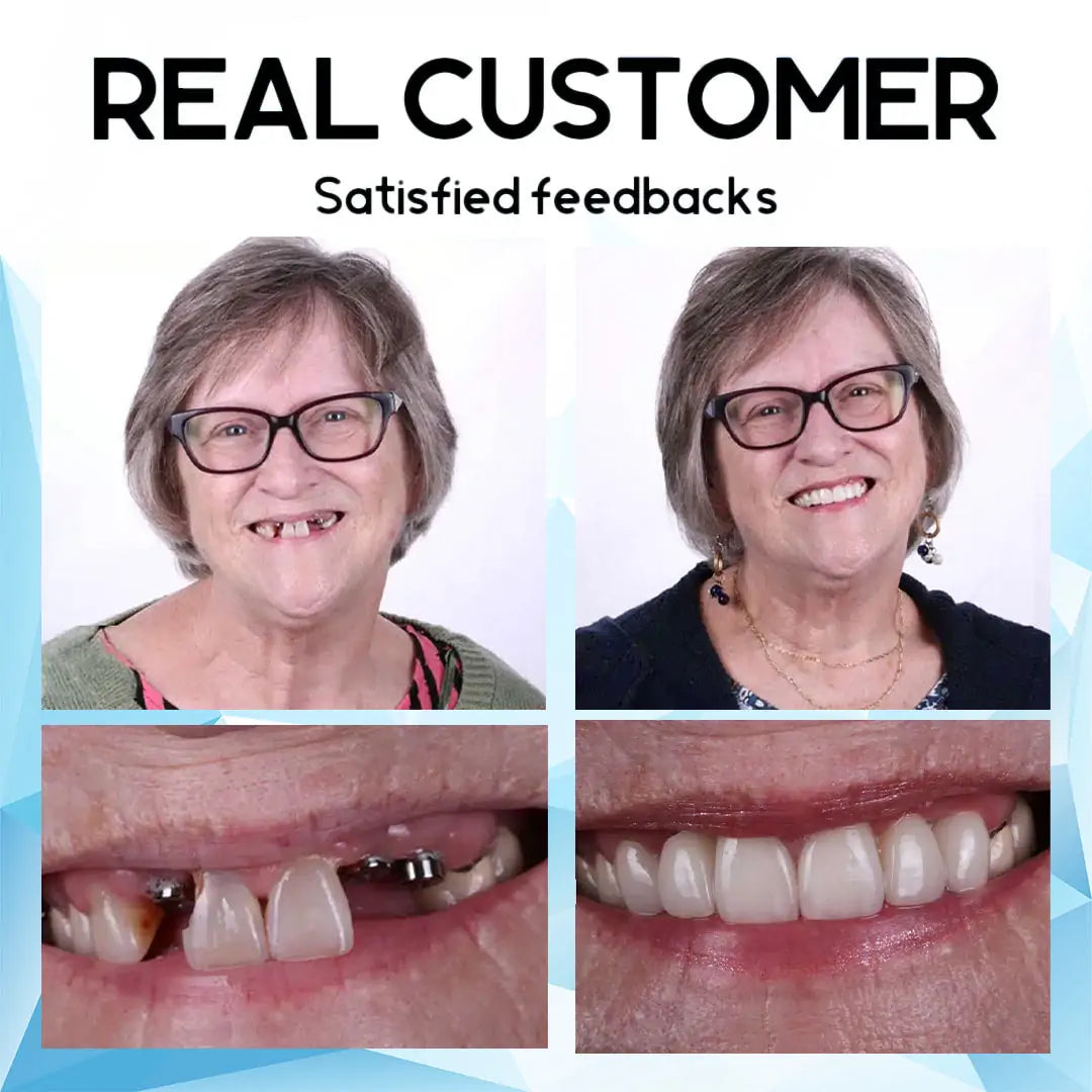 🔥Ｎatravor™- Premium Custom Silicone Denture Set Dual Certification by the American Dental Association (ADA) & the U.S. Food and Drug Administration (FDA)
