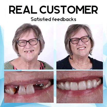 🔥Ｎatravor™- Premium Custom Silicone Denture Set Dual Certification by the American Dental Association (ADA) & the U.S. Food and Drug Administration (FDA)