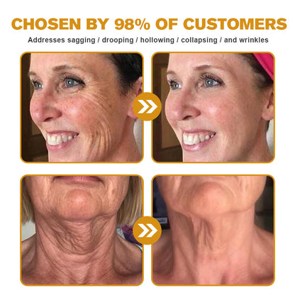 💎👨‍⚕️Made and shipped from the UK✨Ｎatravor™ Botox Bee Venom Wrinkle Removal Cream-Last Day Promotion 70% OFF