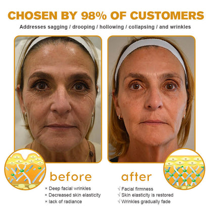 💎👨‍⚕️Made and shipped from the UK✨Ｎatravor™ Botox Bee Venom Wrinkle Removal Cream-Last Day Promotion 70% OFF